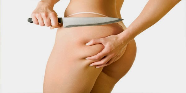 Overview of Cellulite Treatments